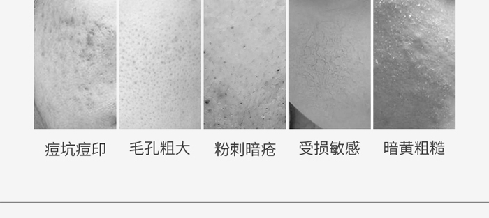 暨美科顏多肽祛痘凍干粉套盒 暨美科顏多肽祛痘凍干粉套盒