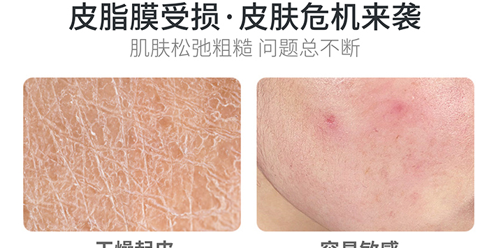 高地保濕修護(hù)霜 高地保濕修護(hù)霜