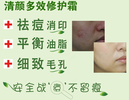 清顏世家祛斑祛痘